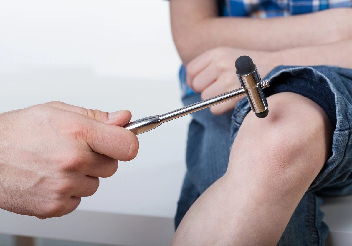 Doctor testing child's reflex with hammer.